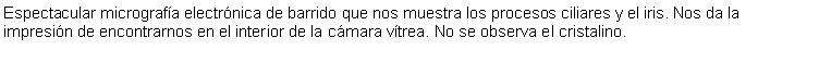 Cuadro de texto: Espectacular micrografa electrnica de barrido que nos muestra los procesos ciliares y el iris. Nos da la impresin de encontrarnos en el interior de la cmara vtrea. No se observa el cristalino.