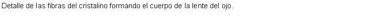 Cuadro de texto: Detalle de las fibras del cristalino formando el cuerpo de la lente del ojo.