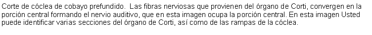 Cuadro de texto: Corte de cclea de cobayo prefundido.  Las fibras nerviosas que provienen del rgano de Corti, convergen en la porcin central formando el nervio auditivo, que en esta imagen ocupa la porcin central. En esta imagen Usted puede identificar varias secciones del rgano de Corti, as como de las rampas de la cclea.