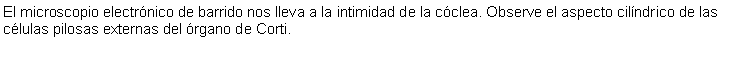 Cuadro de texto: El microscopio electrnico de barrido nos lleva a la intimidad de la cclea. Observe el aspecto cilndrico de las clulas pilosas externas del rgano de Corti.