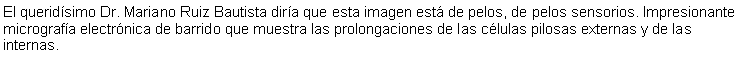 Cuadro de texto: El queridísimo Dr. Mariano Ruiz Bautista diría que esta imagen está de pelos, de pelos sensorios. Impresionante micrografía electrónica de barrido que muestra las prolongaciones de las células pilosas externas y de las internas.
