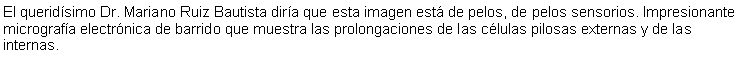 Cuadro de texto: El queridsimo Dr. Mariano Ruiz Bautista dira que esta imagen est de pelos, de pelos sensorios. Impresionante micrografa electrnica de barrido que muestra las prolongaciones de las clulas pilosas externas y de las internas.