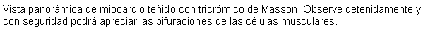 Cuadro de texto: Vista panormica de miocardio teido con tricrmico de Masson. Observe detenidamente y con seguridad podr apreciar las bifuraciones de las clulas musculares.  