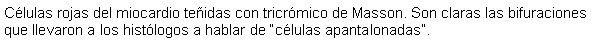 Cuadro de texto: Clulas rojas del miocardio teidas con tricrmico de Masson. Son claras las bifuraciones que llevaron a los histlogos a hablar de clulas apantalonadas.