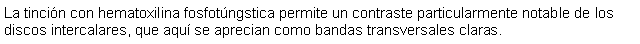 Cuadro de texto: La tincin con hematoxilina fosfotngstica permite un contraste particularmente notable de los discos intercalares, que aqu se aprecian como bandas transversales claras. 