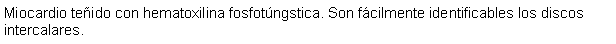 Cuadro de texto: Miocardio teñido con hematoxilina fosfotúngstica. Son fácilmente identificables los discos intercalares.
