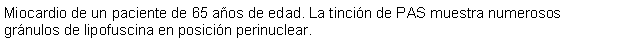 Cuadro de texto: Miocardio de un paciente de 65 aos de edad. La tincin de PAS muestra numerosos grnulos de lipofuscina en posicin perinuclear.