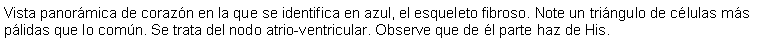 Cuadro de texto: Vista panormica de corazn en la que se identifica en azul, el esqueleto fibroso. Note un tringulo de clulas ms plidas que lo comn. Se trata del nodo atrio-ventricular. Observe que de l parte haz de His. 