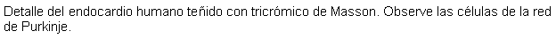 Cuadro de texto: Detalle del endocardio humano teido con tricrmico de Masson. Observe las clulas de la red de Purkinje.