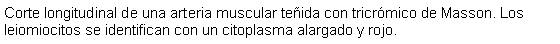 Cuadro de texto: Corte longitudinal de una arteria muscular teida con tricrmico de Masson. Los leiomiocitos se identifican con un citoplasma alargado y rojo. 
