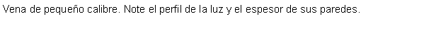 Cuadro de texto: Vena de pequeo calibre. Note el perfil de la luz y el espesor de sus paredes.