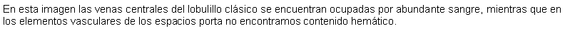 Cuadro de texto: En esta imagen las venas centrales del lobulillo clsico se encuentran ocupadas por abundante sangre, mientras que en los elementos vasculares de los espacios porta no encontramos contenido hemtico.