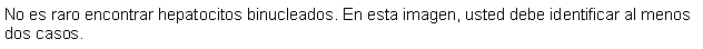Cuadro de texto: No es raro encontrar hepatocitos binucleados. En esta imagen, usted debe identificar al menos dos casos.
