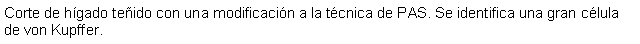 Cuadro de texto: Corte de hgado teido con una modificacin a la tcnica de PAS. Se identifica una gran clula de von Kupffer.