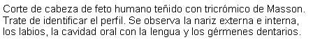 Cuadro de texto: Corte de cabeza de feto humano teido con tricrmico de Masson. Trate de identificar el perfil. Se observa la nariz externa e interna, los labios, la cavidad oral con la lengua y los grmenes dentarios.