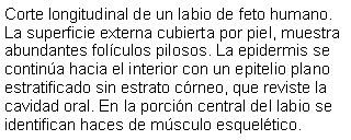 Cuadro de texto: Corte longitudinal de un labio de feto humano. La superficie externa cubierta por piel, muestra abundantes folculos pilosos. La epidermis se contina hacia el interior con un epitelio plano estratificado sin estrato crneo, que reviste la cavidad oral. En la porcin central del labio se identifican haces de msculo esqueltico.