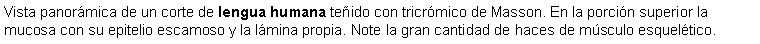 Cuadro de texto: Vista panormica de un corte de lengua humana teido con tricrmico de Masson. En la porcin superior la mucosa con su epitelio escamoso y la lmina propia. Note la gran cantidad de haces de msculo esqueltico.