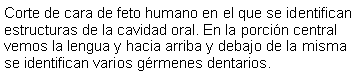 Cuadro de texto: Corte de cara de feto humano en el que se identifican estructuras de la cavidad oral. En la porcin central vemos la lengua y hacia arriba y debajo de la misma se identifican varios grmenes dentarios.