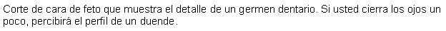 Cuadro de texto: Corte de cara de feto que muestra el detalle de un germen dentario. Si usted cierra los ojos un poco, percibir el perfil de un duende.