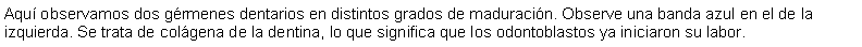 Cuadro de texto: Aqu observamos dos grmenes dentarios en distintos grados de maduracin. Observe una banda azul en el de la izquierda. Se trata de colgena de la dentina, lo que significa que los odontoblastos ya iniciaron su labor.