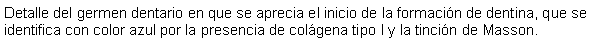 Cuadro de texto: Detalle del germen dentario en que se aprecia el inicio de la formacin de dentina, que se identifica con color azul por la presencia de colgena tipo I y la tincin de Masson.