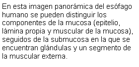 Cuadro de texto: En esta imagen panormica del esfago humano se pueden distinguir los componentes de la mucosa (epitelio, lmina propia y muscular de la mucosa), seguidos de la submucosa en la que se encuentran glndulas y un segmento de la muscular externa.