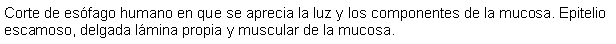 Cuadro de texto: Corte de esfago humano en que se aprecia la luz y los componentes de la mucosa. Epitelio escamoso, delgada lmina propia y muscular de la mucosa. 