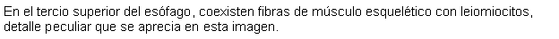 Cuadro de texto: En el tercio superior del esfago, coexisten fibras de msculo esqueltico con leiomiocitos, detalle peculiar que se aprecia en esta imagen.