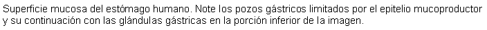 Cuadro de texto: Superficie mucosa del estmago humano. Note los pozos gstricos limitados por el epitelio mucoproductor y su continuacin con las glndulas gstricas en la porcin inferior de la imagen.