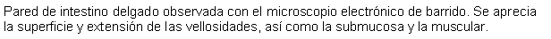Cuadro de texto: Pared de intestino delgado observada con el microscopio electrónico de barrido. Se aprecia la superficie y extensión de las vellosidades, así como la submucosa y la muscular.
