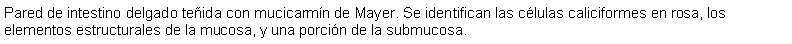 Cuadro de texto: Pared de intestino delgado teida con mucicarmn de Mayer. Se identifican las clulas caliciformes en rosa, los elementos estructurales de la mucosa, y una porcin de la submucosa. 