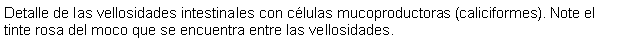 Cuadro de texto: Detalle de las vellosidades intestinales con clulas mucoproductoras (caliciformes). Note el tinte rosa del moco que se encuentra entre las vellosidades.