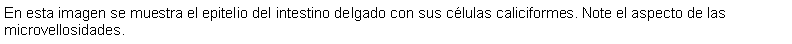 Cuadro de texto: En esta imagen se muestra el epitelio del intestino delgado con sus clulas caliciformes. Note el aspecto de las microvellosidades.