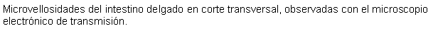 Cuadro de texto: Microvellosidades del intestino delgado en corte transversal, observadas con el microscopio electrnico de transmisin.