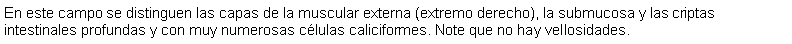 Cuadro de texto: En este campo se distinguen las capas de la muscular externa (extremo derecho), la submucosa y las criptas intestinales profundas y con muy numerosas clulas caliciformes. Note que no hay vellosidades.