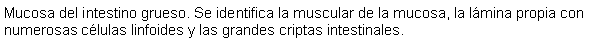 Cuadro de texto: Mucosa del intestino grueso. Se identifica la muscular de la mucosa, la lmina propia con numerosas clulas linfoides y las grandes criptas intestinales.