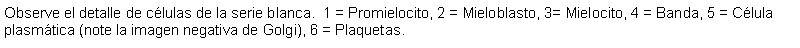 Cuadro de texto: Observe el detalle de clulas de la serie blanca.  1 = Promielocito, 2 = Mieloblasto, 3= Mielocito, 4 = Banda, 5 = Clula plasmtica (note la imagen negativa de Golgi), 6 = Plaquetas.