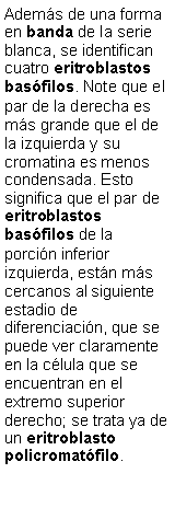 Cuadro de texto: Adems de una forma en banda de la serie blanca, se identifican cuatro eritroblastos basfilos. Note que el par de la derecha es ms grande que el de la izquierda y su cromatina es menos condensada. Esto significa que el par de eritroblastos basfilos de la porcin inferior izquierda, estn ms cercanos al siguiente estadio de diferenciacin, que se puede ver claramente en la clula que se encuentran en el extremo superior derecho; se trata ya de un eritroblasto policromatfilo. 