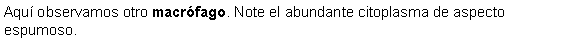 Cuadro de texto: Aquí observamos otro macrófago. Note el abundante citoplasma de aspecto espumoso. 
