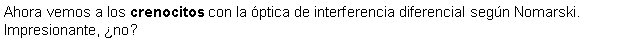 Cuadro de texto: Ahora vemos a los crenocitos con la ptica de interferencia diferencial segn Nomarski. Impresionante, no?