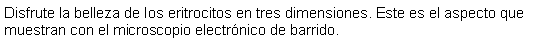 Cuadro de texto: Disfrute la belleza de los eritrocitos en tres dimensiones. Este es el aspecto que muestran con el microscopio electrnico de barrido. 