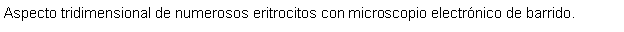 Cuadro de texto: Aspecto tridimensional de numerosos eritrocitos con microscopio electrnico de barrido.