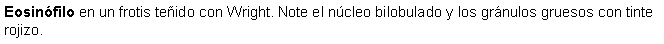 Cuadro de texto: Eosinfilo en un frotis teido con Wright. Note el ncleo bilobulado y los grnulos gruesos con tinte rojizo.