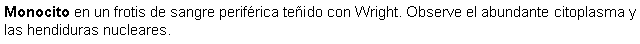 Cuadro de texto: Monocito en un frotis de sangre perifrica teido con Wright. Observe el abundante citoplasma y las hendiduras nucleares.