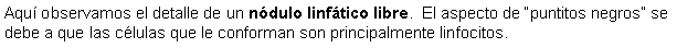 Cuadro de texto: Aqu observamos el detalle de un ndulo linftico libre.  El aspecto de puntitos negros se debe a que las clulas que le conforman son principalmente linfocitos.