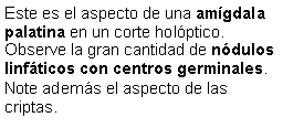 Cuadro de texto: Este es el aspecto de una amgdala palatina en un corte holptico. Observe la gran cantidad de ndulos linfticos con centros germinales. Note adems el aspecto de las criptas.