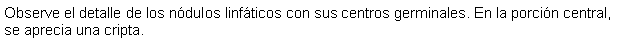 Cuadro de texto: Observe el detalle de los ndulos linfticos con sus centros germinales. En la porcin central, se aprecia una cripta. 