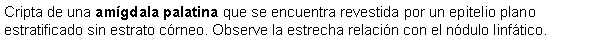 Cuadro de texto: Cripta de una amgdala palatina que se encuentra revestida por un epitelio plano estratificado sin estrato crneo. Observe la estrecha relacin con el ndulo linftico.