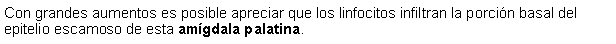 Cuadro de texto: Con grandes aumentos es posible apreciar que los linfocitos infiltran la porcin basal del epitelio escamoso de esta amgdala palatina.