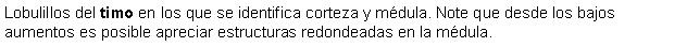 Cuadro de texto: Lobulillos del timo en los que se identifica corteza y mdula. Note que desde los bajos aumentos es posible apreciar estructuras redondeadas en la mdula.